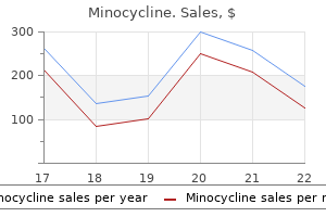 cheap minocycline 50 mg line