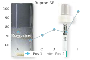 order bupron sr 150mg otc