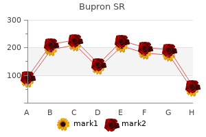 150 mg bupron sr