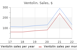 buy generic ventolin 100mcg on line