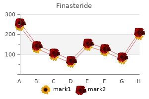 finasteride 1 mg generic