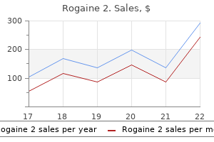 generic rogaine 2 60 ml fast delivery