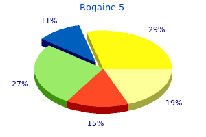 60ml rogaine 5 free shipping